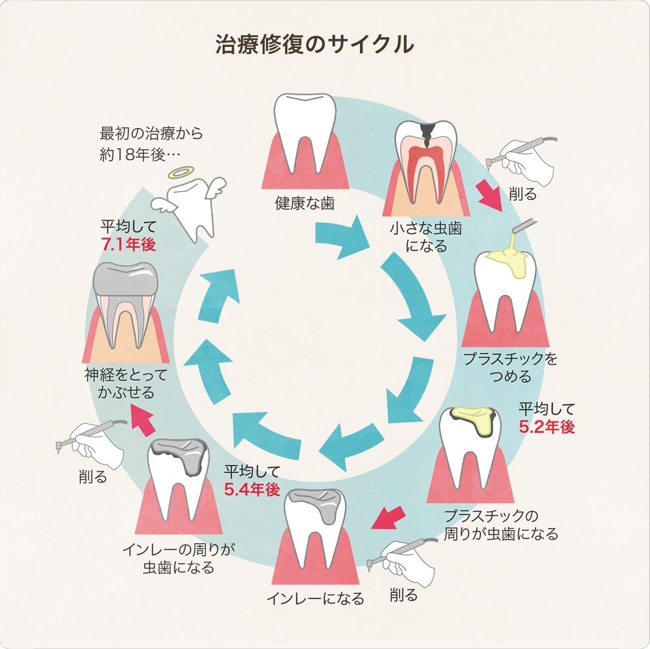 予防治療